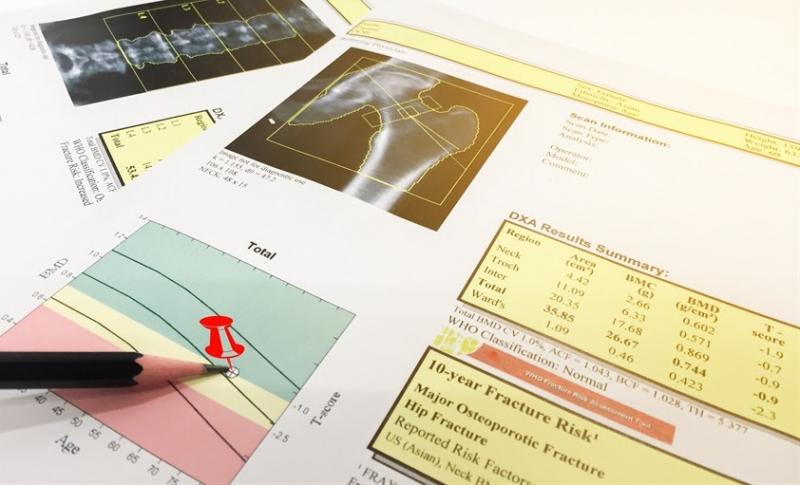 Phiếu kết quả đo loãng xương