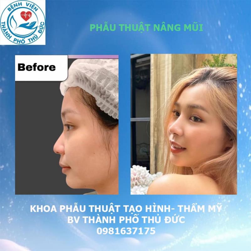 Khoa Phẫu Thuật Tạo Hình Thẩm Mỹ - Bệnh viện thành phố Thủ Đức