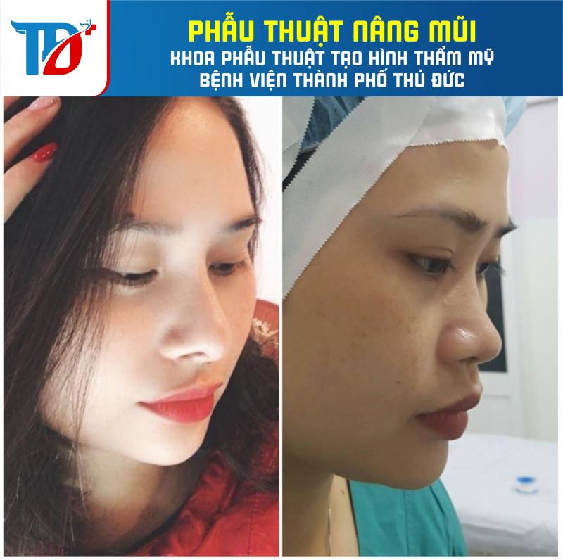 Khoa Phẫu Thuật Tạo Hình Thẩm Mỹ - Bệnh viện thành phố Thủ Đức