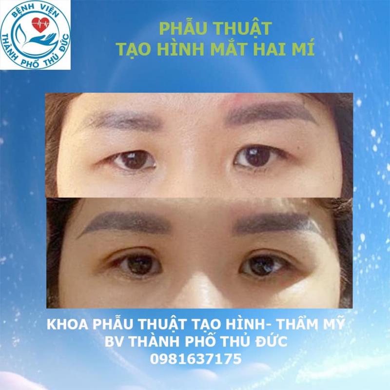 Khoa Phẫu Thuật Tạo Hình Thẩm Mỹ - Bệnh viện thành phố Thủ Đức