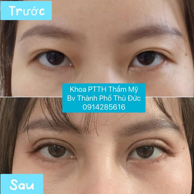 Khoa Phẫu Thuật Tạo Hình Thẩm Mỹ - Bệnh viện thành phố Thủ Đức