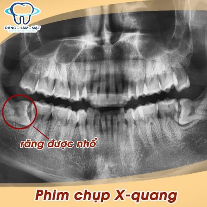 Khoa Răng Hàm Mặt - Bệnh viện đa khoa khu vực Phúc Yên