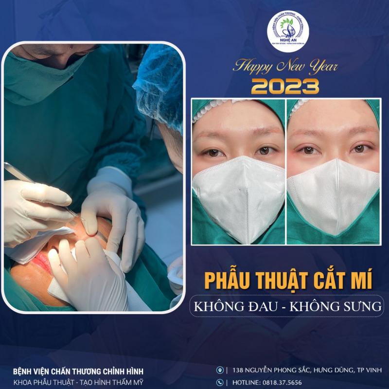 Khoa Thẩm mỹ của Bệnh viện Chấn thương - Chỉnh hình Nghệ An