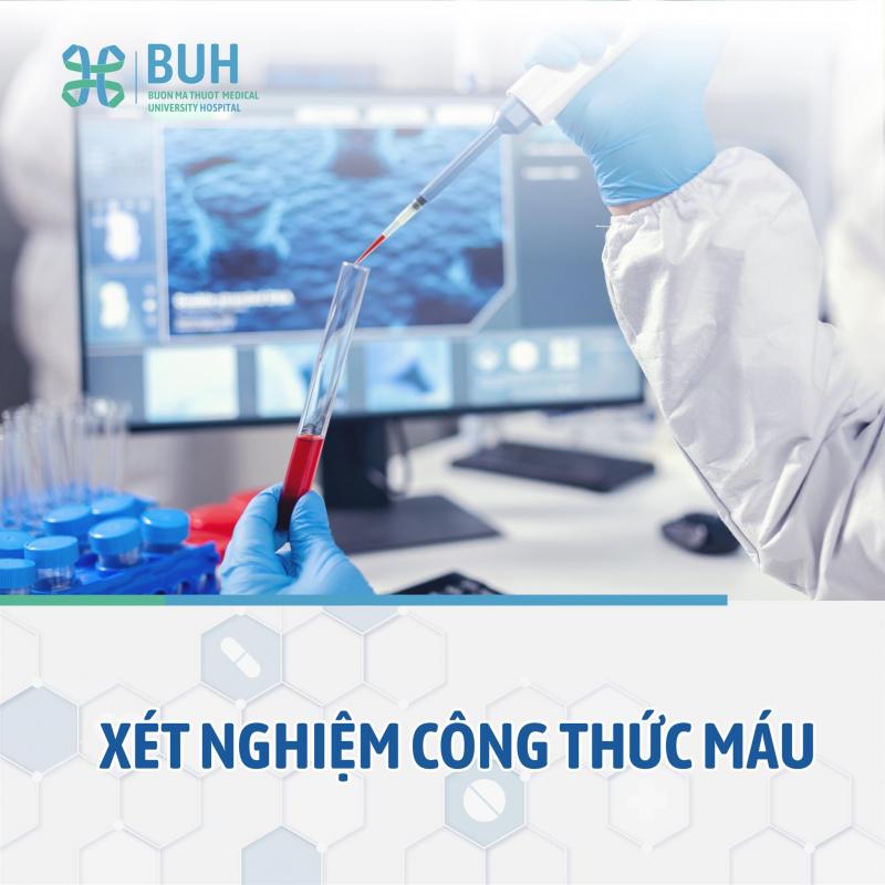 Khoa Xét Nghiệm BUH - Bệnh viện Đại học Y Dược Buôn Ma Thuột (BUH)