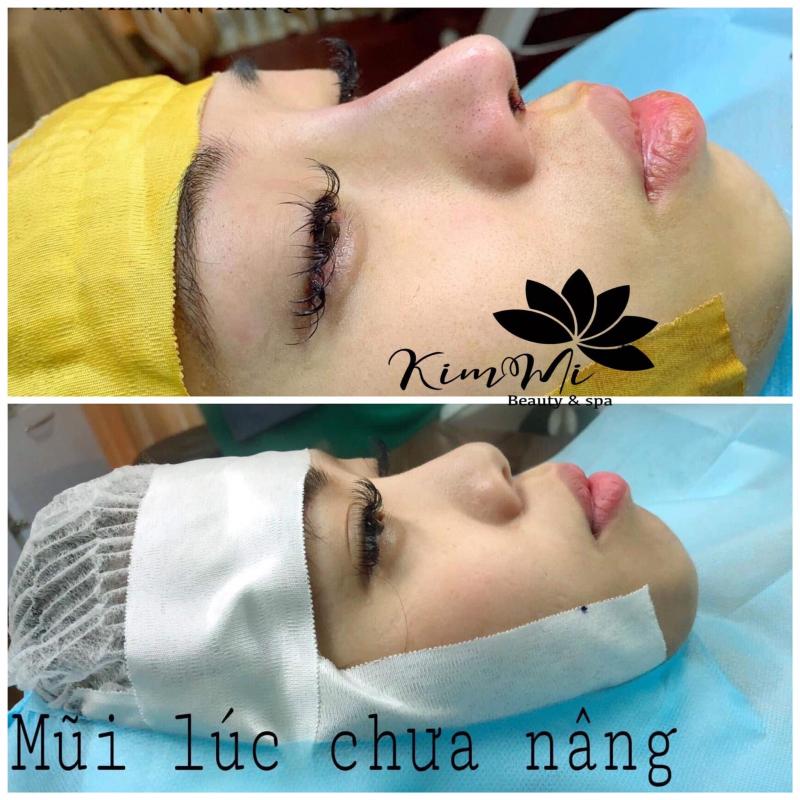 Thẩm mỹ viện Kimmi