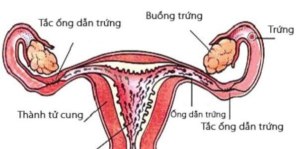 Vòng kinh bị đảo lộn