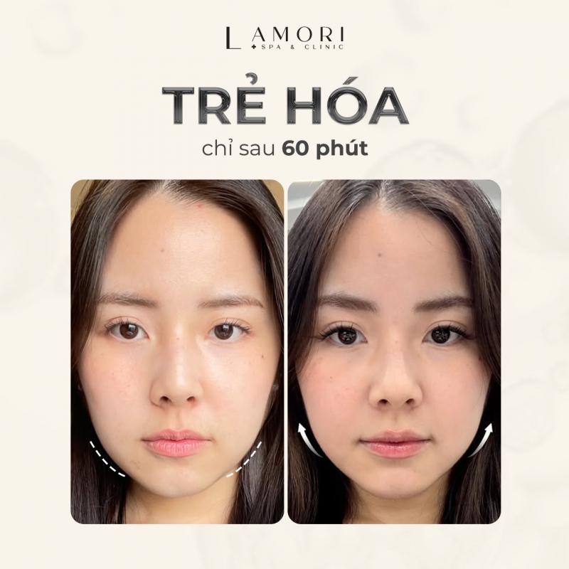 La Mori Spa & Clinic