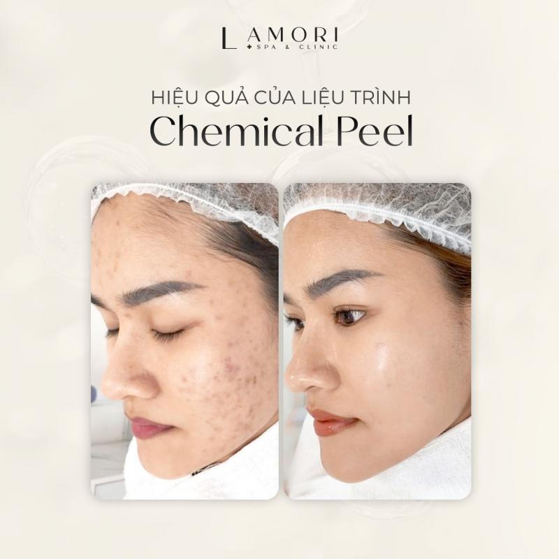 La Mori Spa & Clinic