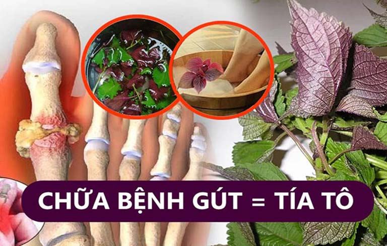 Chữa bệnh gout bằng lá tía tô