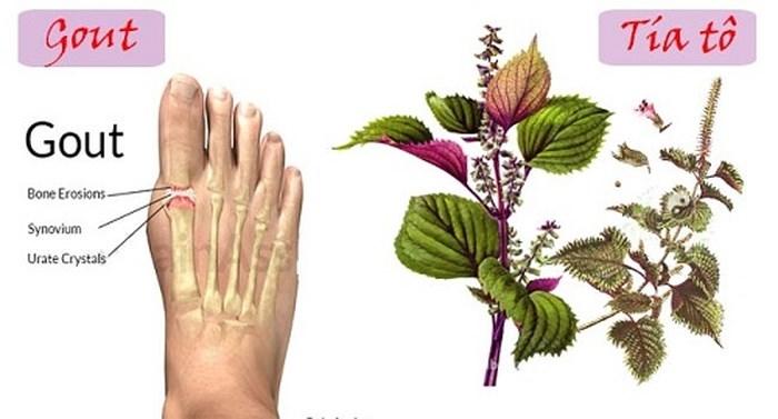 Tía tô với bệnh gút (gout)