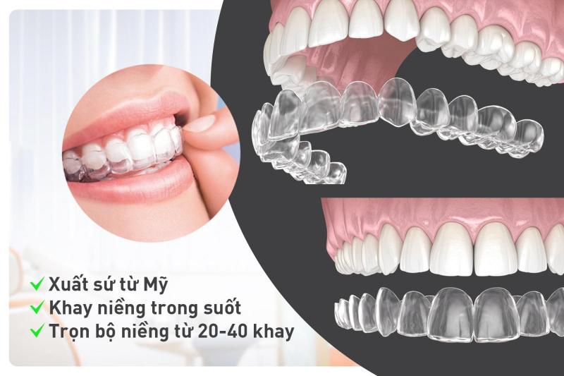 Làm thế nào để chăm sóc và làm sạch các ố vàng trên nẹp niềng răng Invisalign?