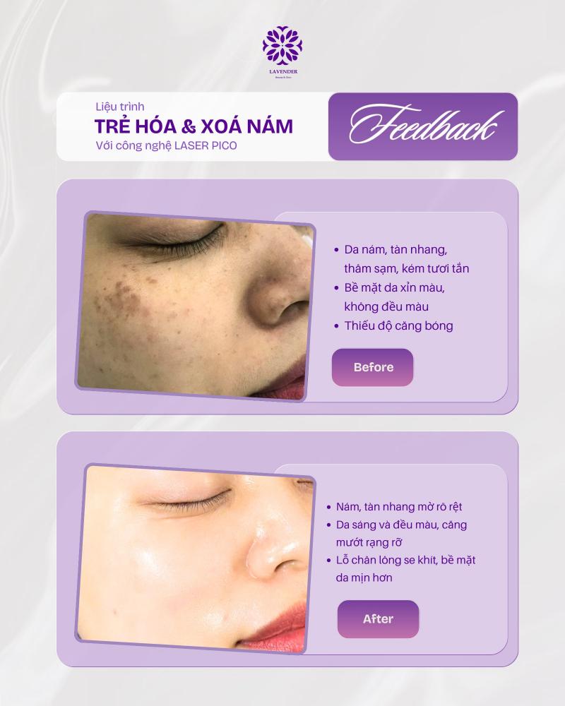 Lavender Beauty & Clinic