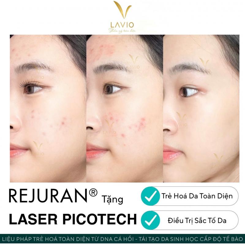 LAVIO Spa & Clinic – Spa làm đẹp uy tín Cần Thơ chăm sóc da chuyên sâu