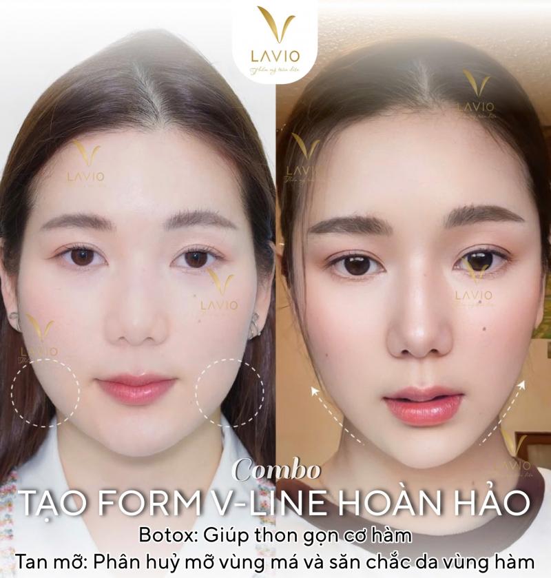 LAVIO Spa & Clinic – Spa làm đẹp uy tín Cần Thơ chăm sóc da chuyên sâu