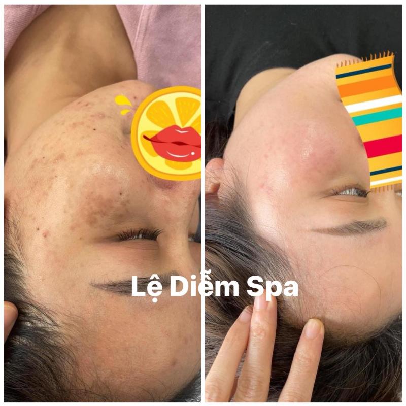 Lệ Diễm Spa