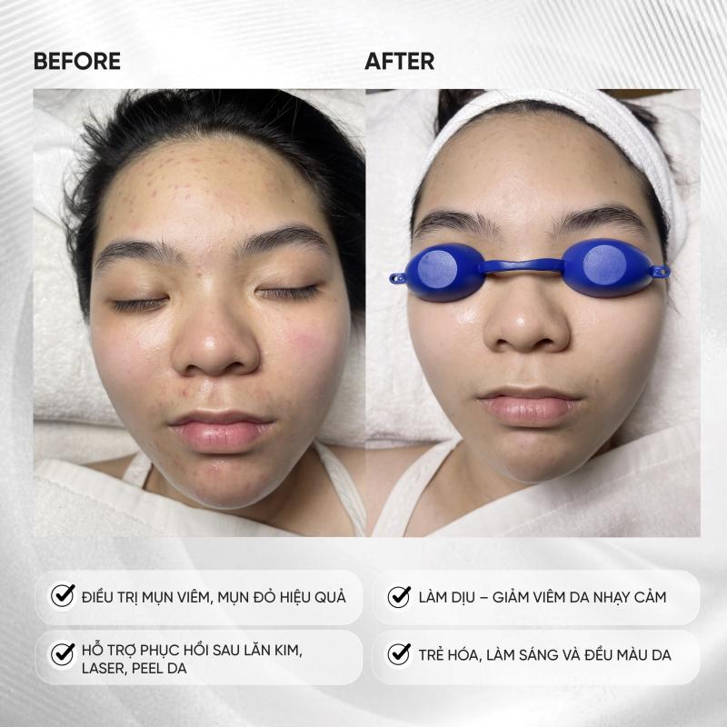 Leda Clinic – Spa chăm sóc da chuẩn Châu Âu cao cấp tại Hà Nội