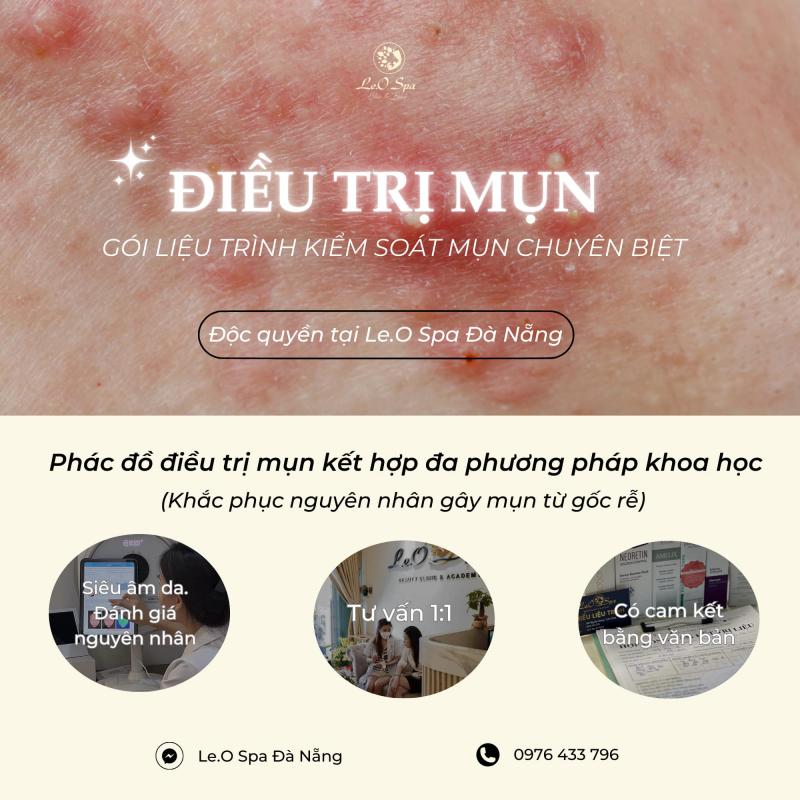 Le.O Spa Đà Nẵng - Spa Trị Mụn Uy Tín Có Cam Kết Bằng Văn Bản