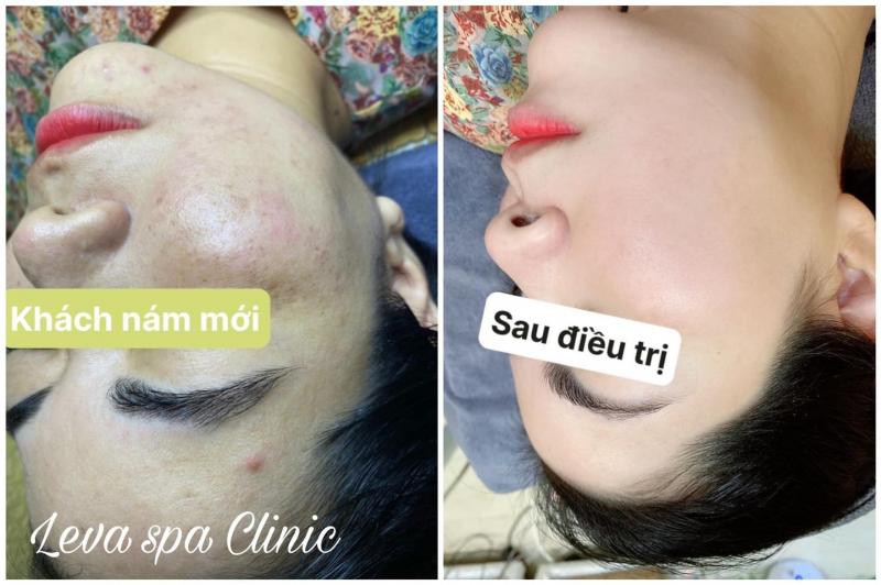 Leva Spa Clinic