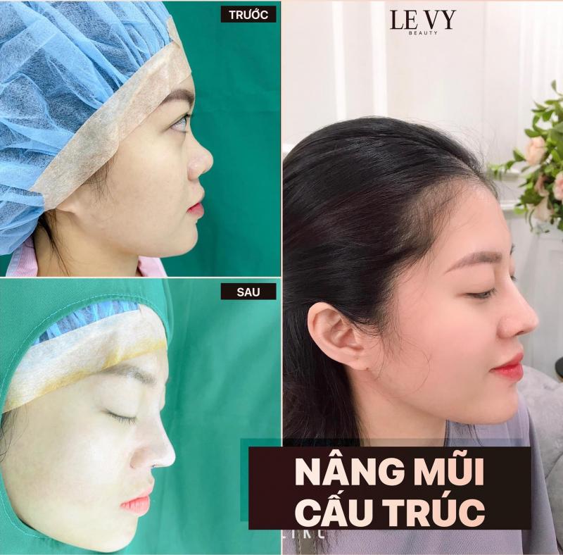 LEVY Beauty - Thẩm Mỹ