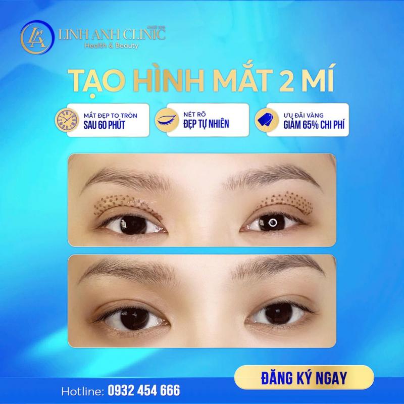 Linh Anh Beauty Clinic