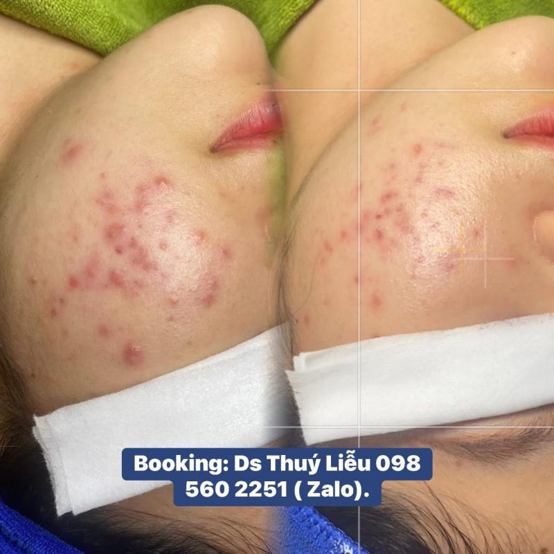 Liuu Beauty Spa & Clinic Bình Dương