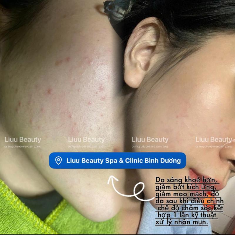 Liuu Beauty Spa & Clinic Bình Dương