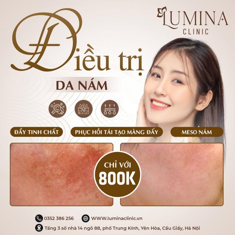 Lumina Clinic - spa chữa nám hàng đầu Hà Nội