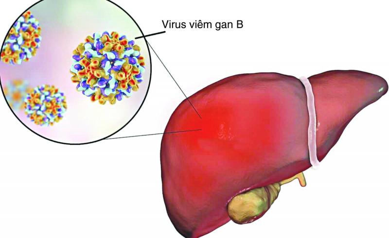 Bệnh nhân đang bị suy gan nặng cần được đánh giá đều đặn về các chỉ số enzym gan khi dùng