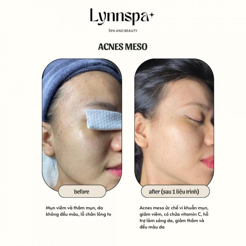 Lynn Spa - Spa and Beauty Cần Thơ