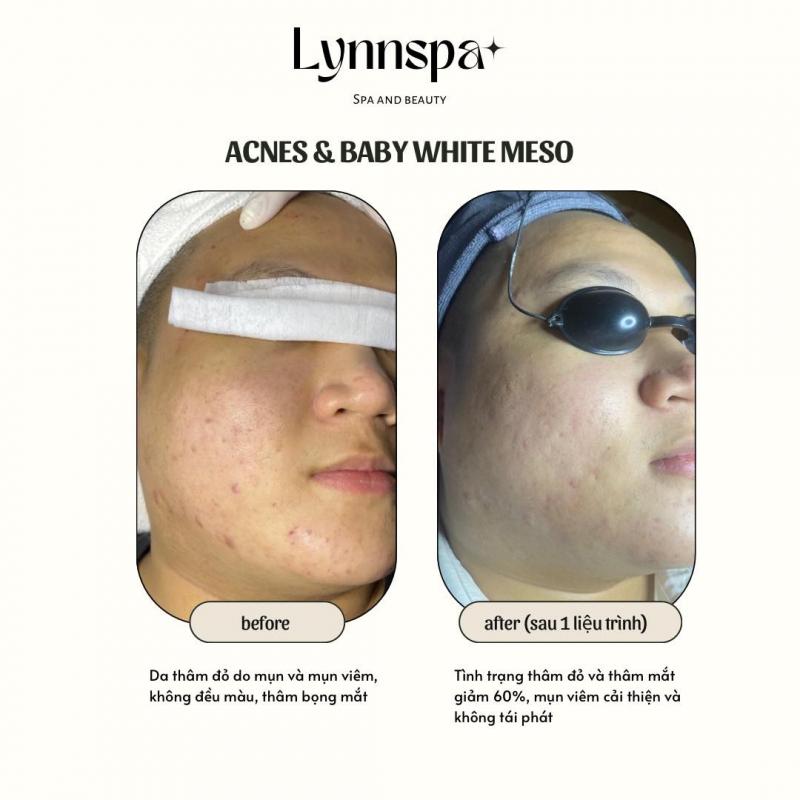 Lynn Spa - Spa and Beauty Cần Thơ