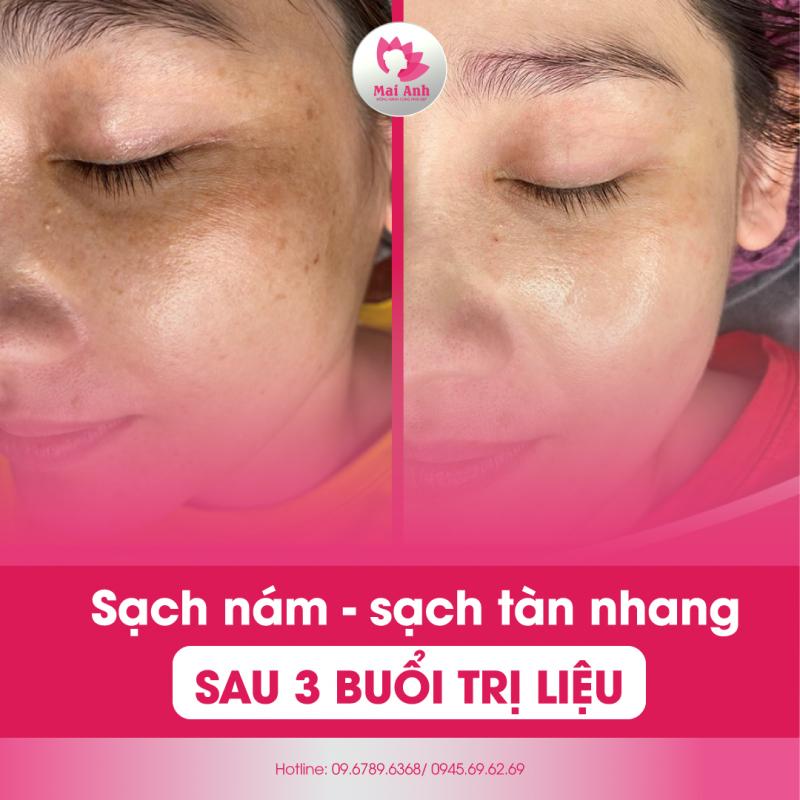 Mai Anh Spa