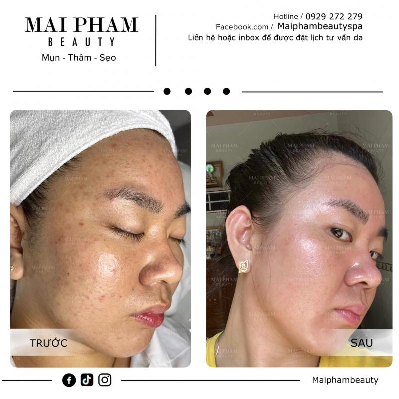 Mai Phạm Beauty Spa