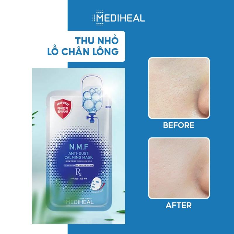 Mặt Nạ Thải Độc, Cấp Nước Và Phục Hồi Da Mediheal N.M.F Anti-Dust Calming Mask