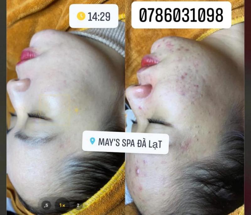 May's Spa Đà Lạt