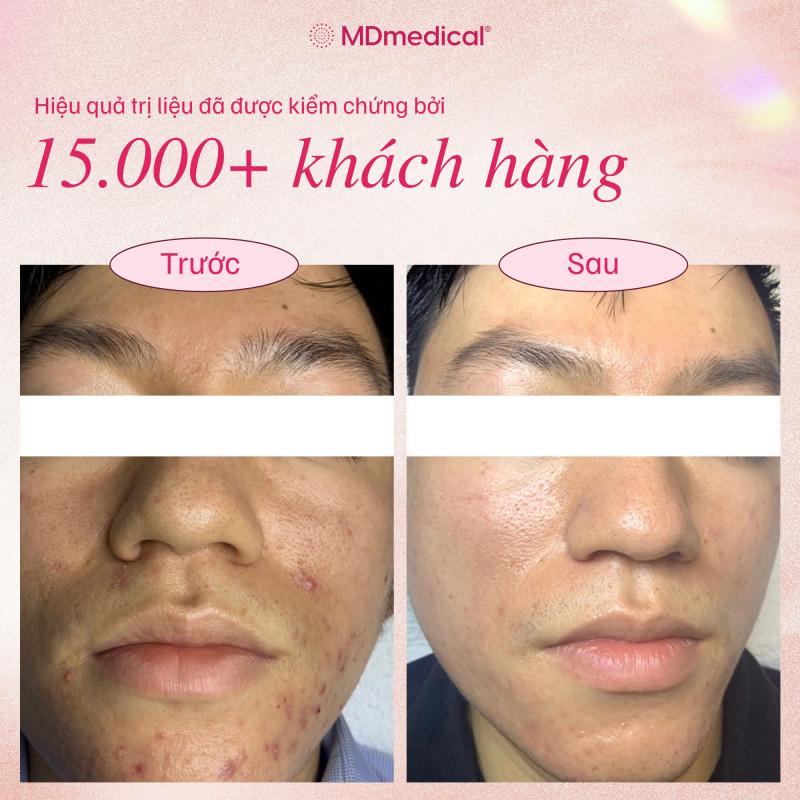 MDmedical - Trị liệu & Chăm sóc da