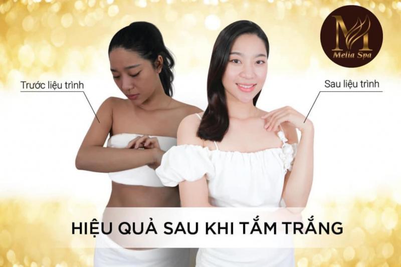 Top 5 Spa tắm trắng uy tín nhất tỉnh Hà Tĩnh