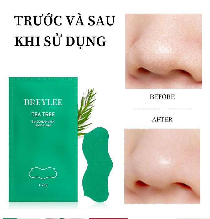 Miếng dán lột mụn Breylee