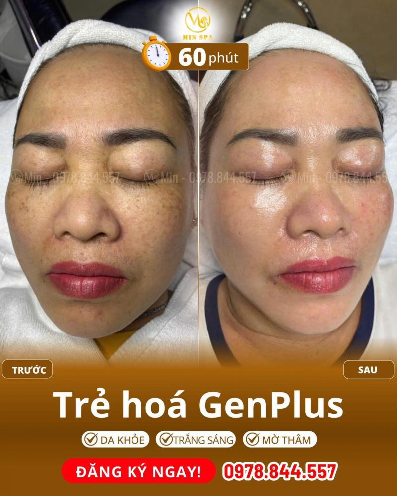 Min Beauty Spa Bắc Ninh