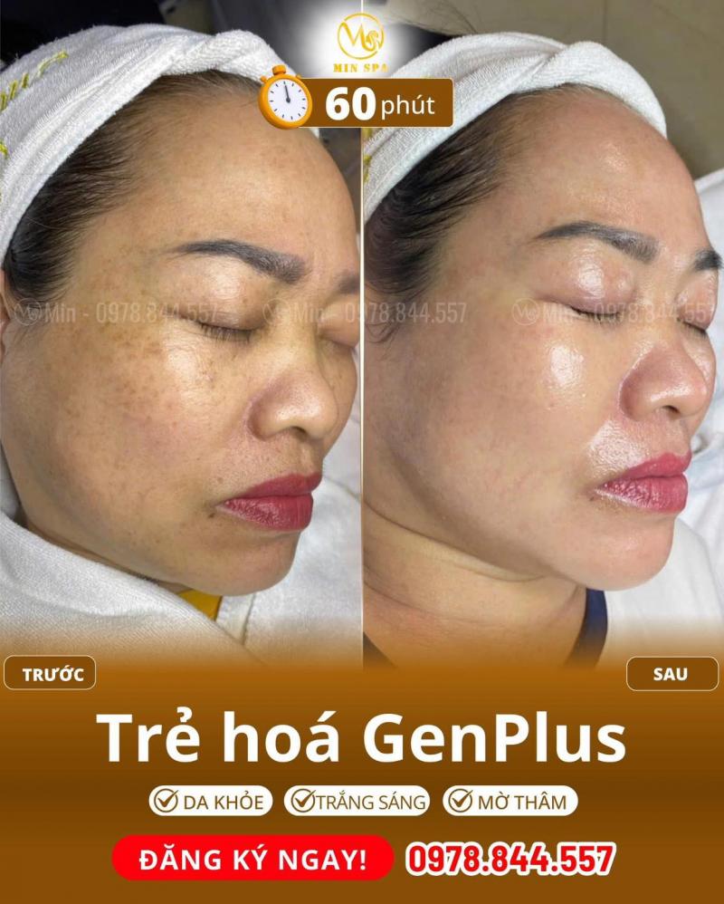 Min Beauty Spa Bắc Ninh