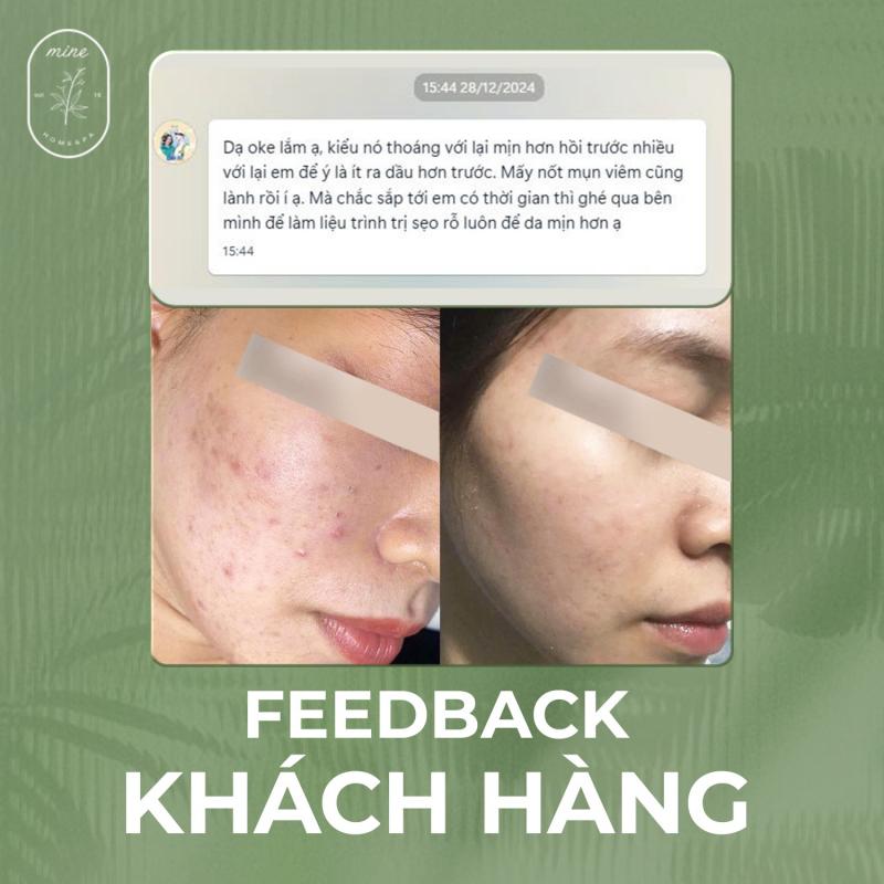 Mine homespa - Trị Mụn Chuyên Nghiệp, Hiệu Quả Tại Đồng Nai