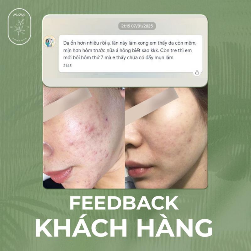 Mine homespa - Trị Mụn Chuyên Nghiệp, Hiệu Quả Tại Đồng Nai