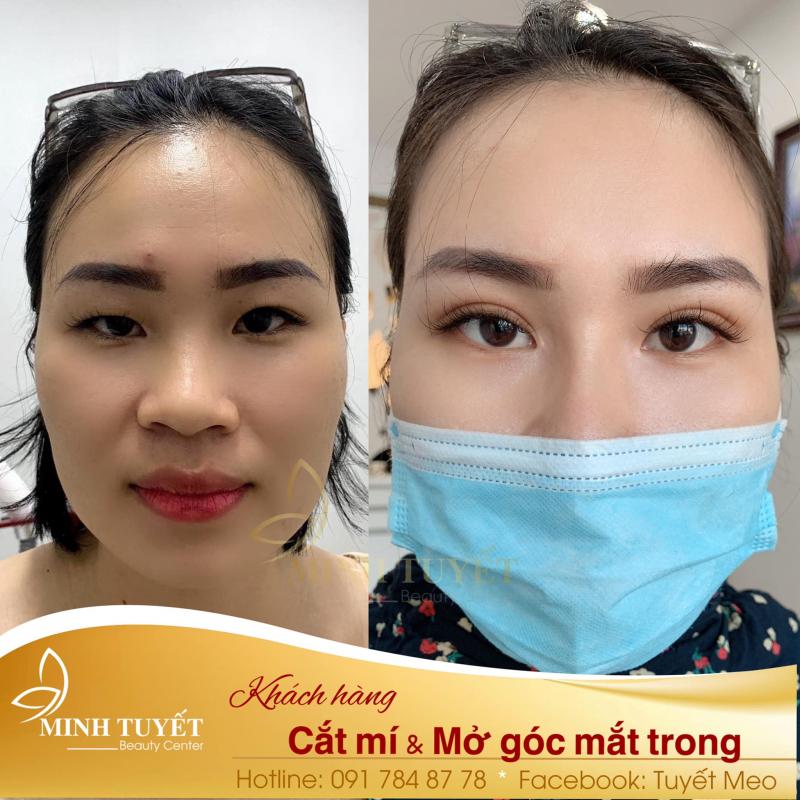 Minh Tuyết Beauty Center