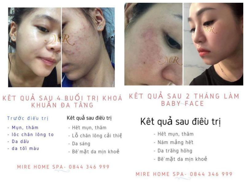 MiRe Home Spa - Kim Thiên Hoa