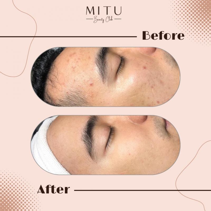 MITU Beauty Club