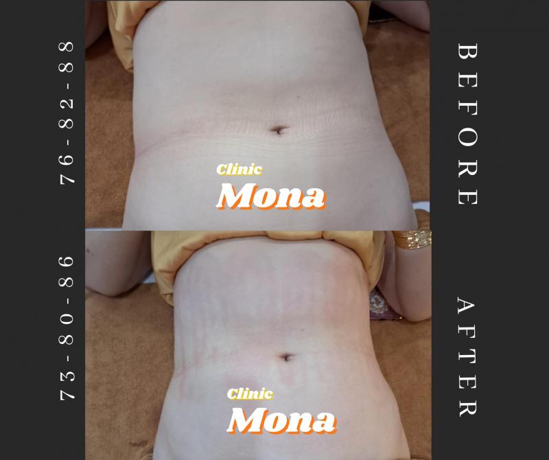 Mona Elite Clinic & Spa