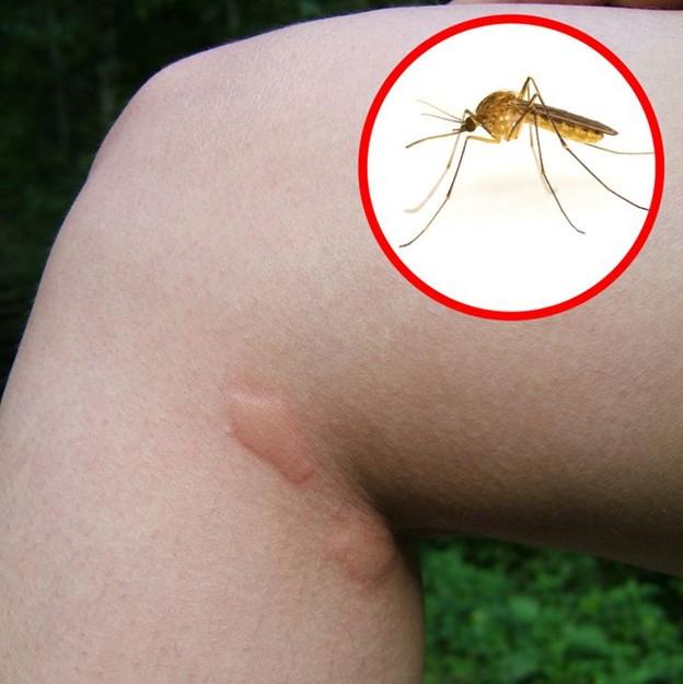 Muỗi