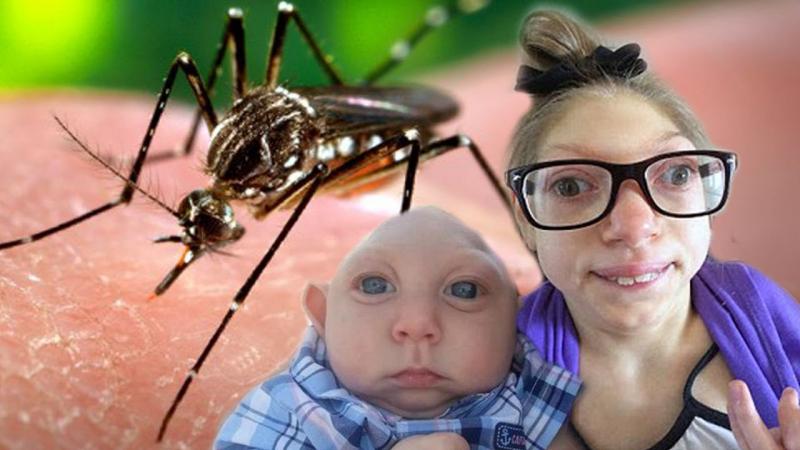 Muỗi lây truyền virus Zika gây hiện tượng đầu nhỏ ở trẻ