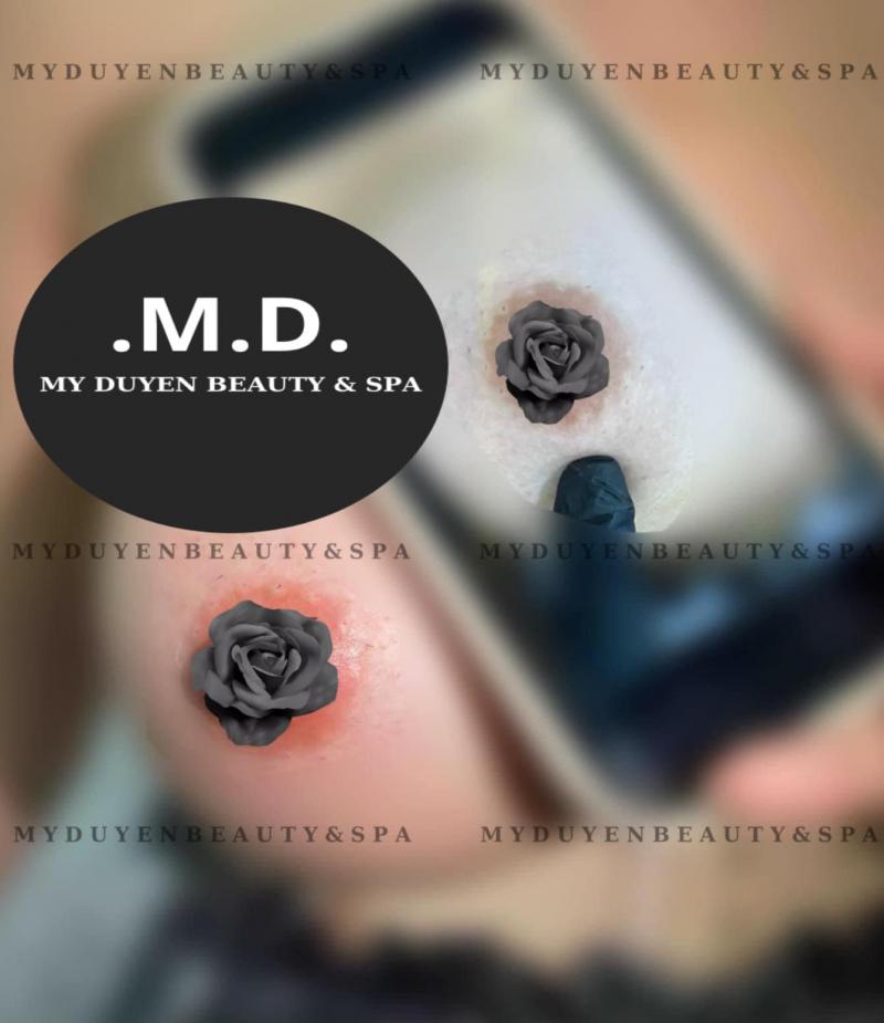 Mỹ Duyên Beauty & Spa