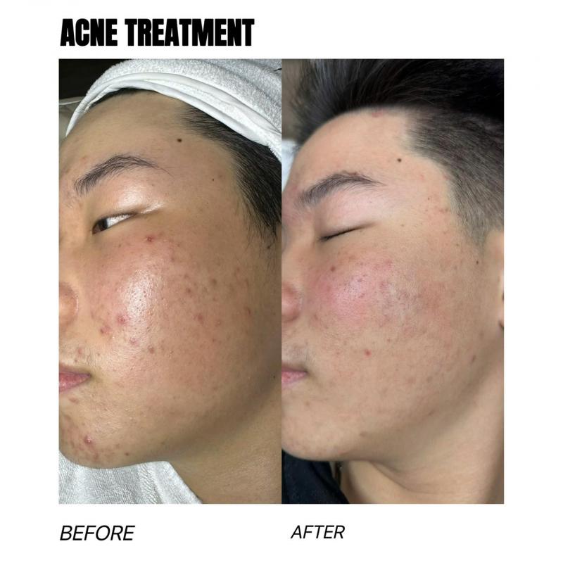 M.Y SkinLab – Spa Trị Mụn Được Tin Chọn Nhất Hải Phòng