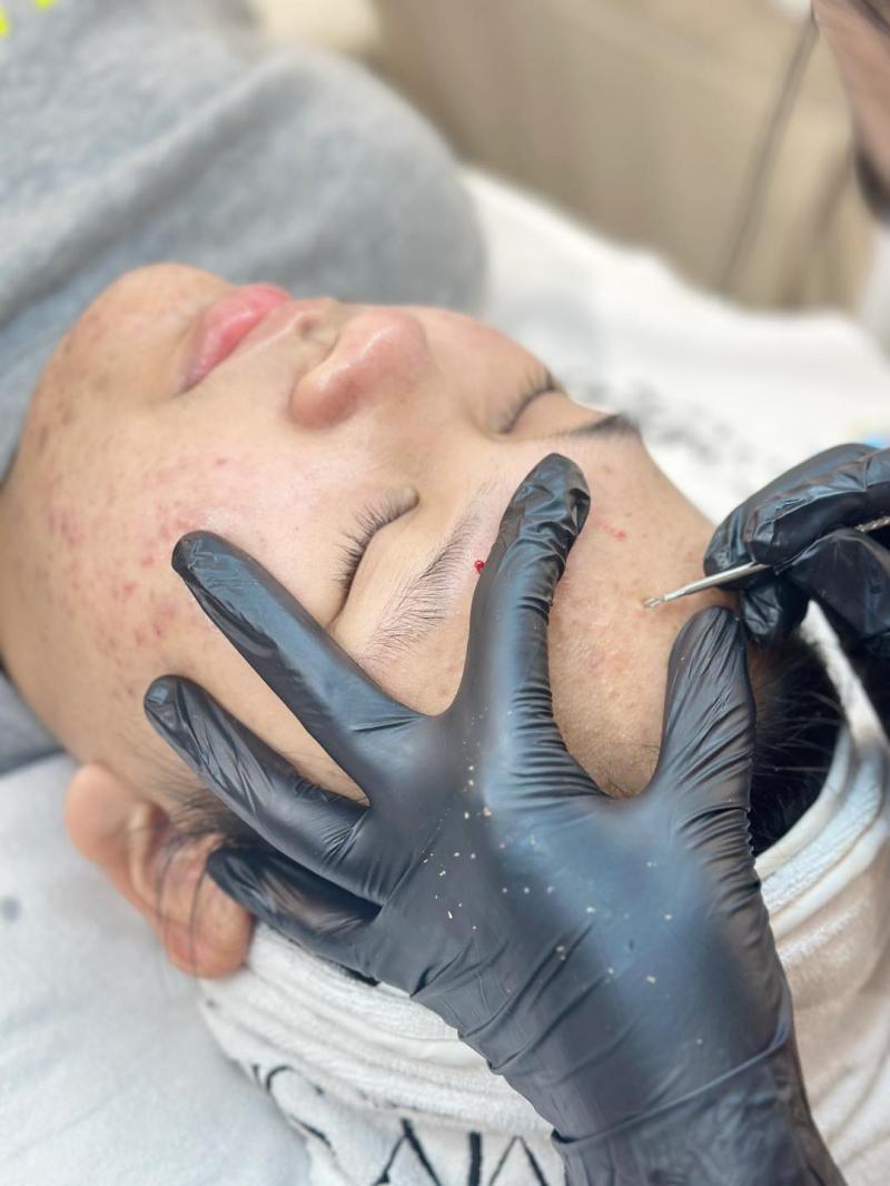 M.Y SkinLab – Spa Trị Mụn Được Tin Chọn Nhất Hải Phòng